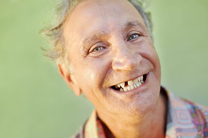 Why Replacing A Lost Tooth Is Important Why Replacing A Lost Tooth Is Important